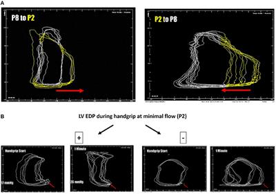 The “TIDE”-Algorithm for the Weaning of Patients With Cardiogenic Shock and Temporarily Mechanical Left Ventricular Support With Impella Devices. A Cardiovascular Physiology-Based Approach